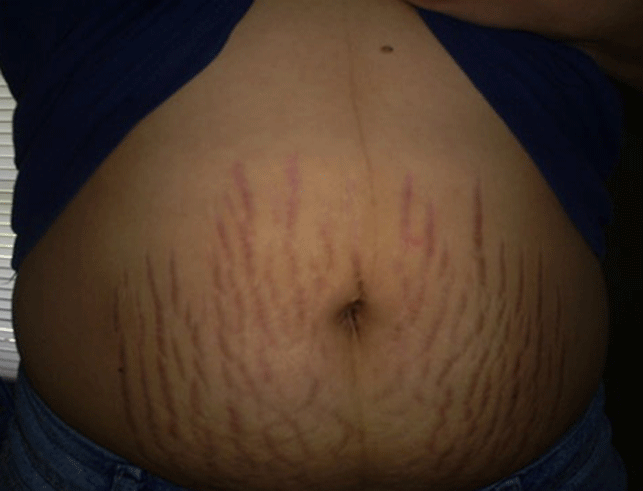 Dore imiti y'umwimerere wakoresha wirukana amaribori ku mubiri