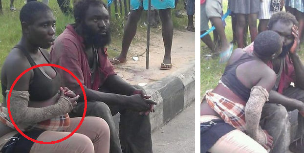 Abantu 2 bafite uburwayi bwo mu mutwe bagereranwa nka Romeo na Juliet bamaranye imyaka 22 babana nk’umugabo n’umugore 