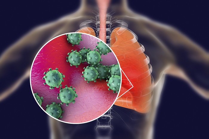 Coronavirus: Ihumure ku batuye Isi riturutse mu kigo cya Biotech Synairgen kiri kugerageza umuti uri gutanga icyizere