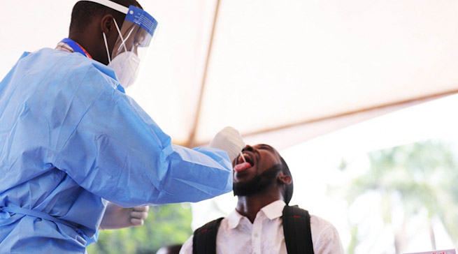 Gupima Covid-19 mu buryo bwihuse (Rapid test) mu mavuriro yigenga byashyizwe ku 5,000 Frw