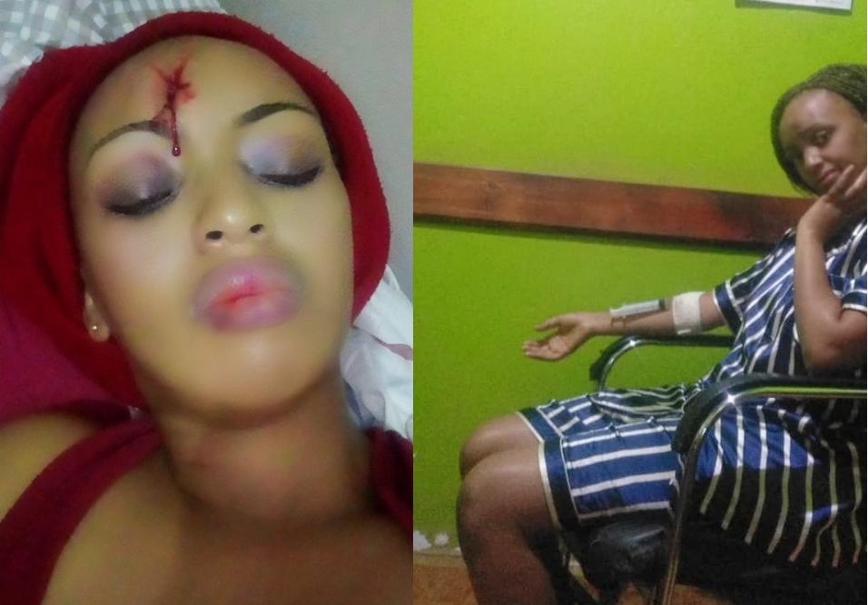 Narungurutse ku rupfu, nari naraye ndose napfuye: Ishimwe rya Selena Rosy warokotse impanuka yakoreye muri 'Douche'-AMAFOTO