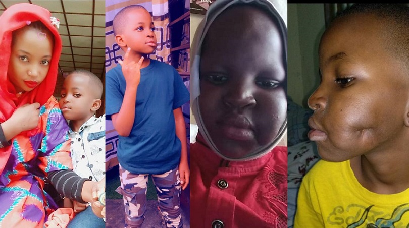 Umubyeyi umaze umwaka avuza umwana kanseri mu Buhinde aratabaza